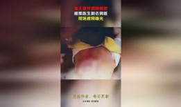 缅北医生爆料视频大全集,真实事件背后的惊心动魄